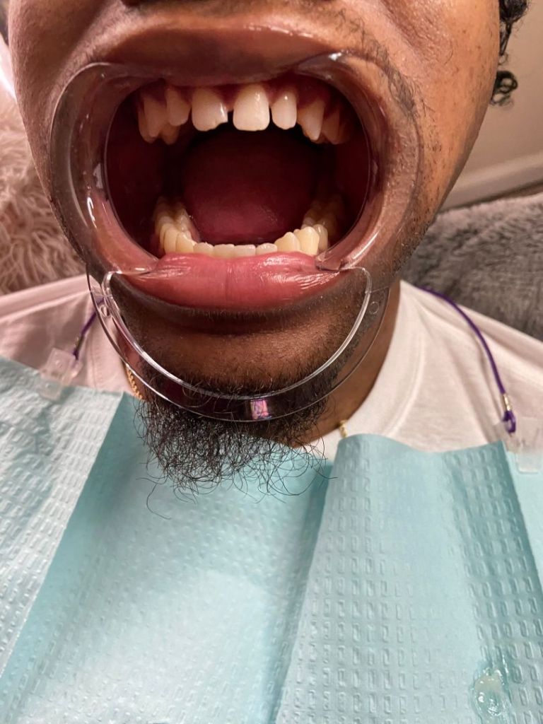 Meet Destanie Render Teeth whitening & tooth gem tech SHOUTOUT ATLANTA