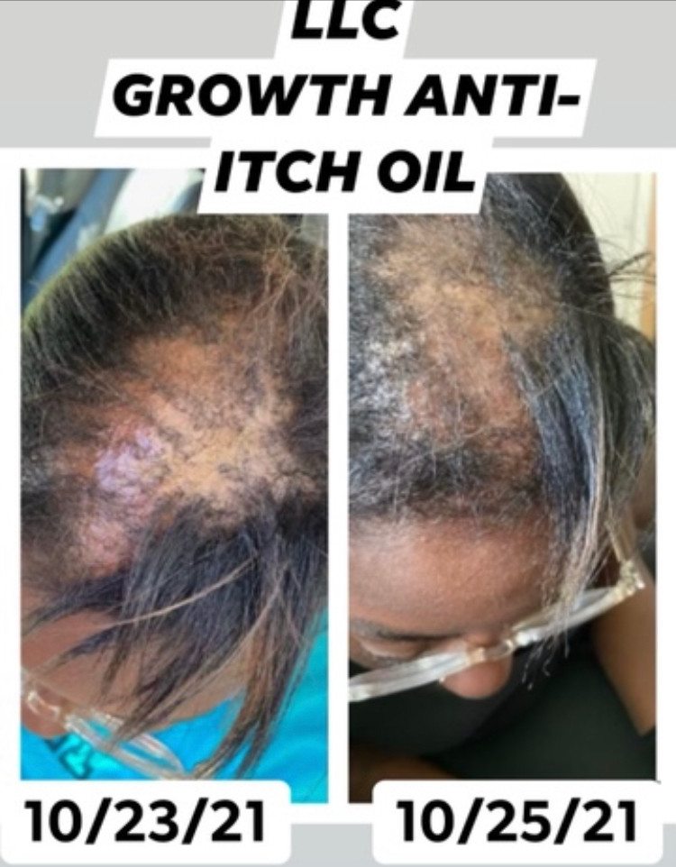 Meet Kieta Rivens Hair Growth Guru SHOUTOUT ATLANTA