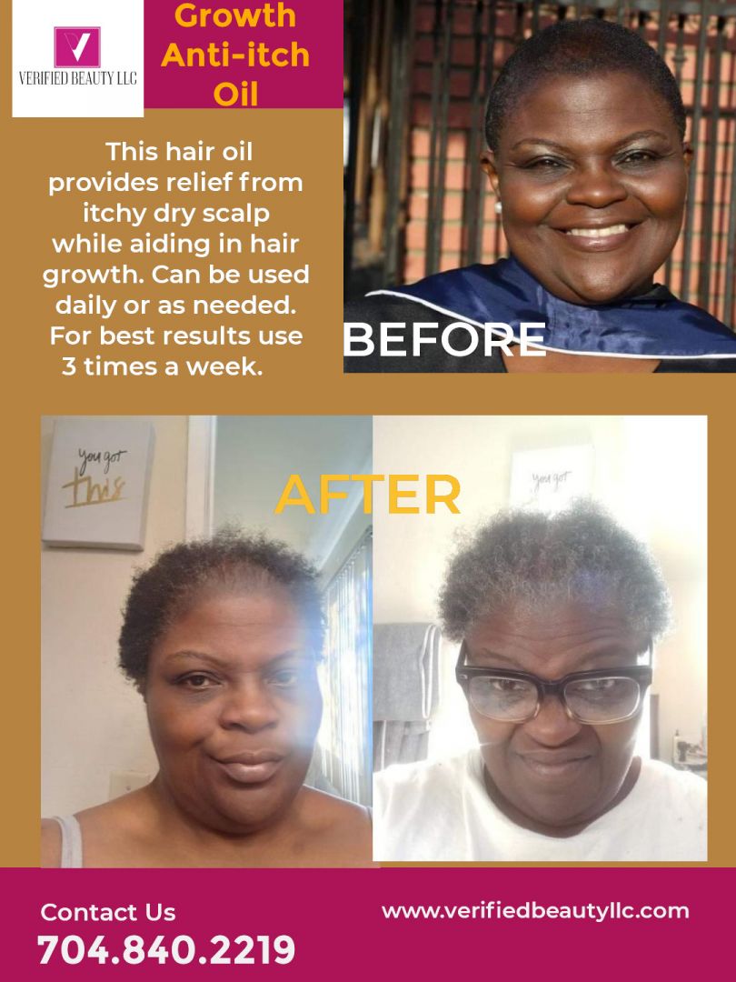 Meet Kieta Rivens Hair Growth Guru SHOUTOUT ATLANTA